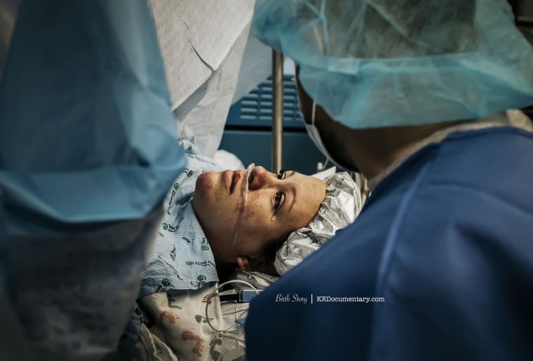 In November 2016, Scholz photographed twin boys being born via C-section.