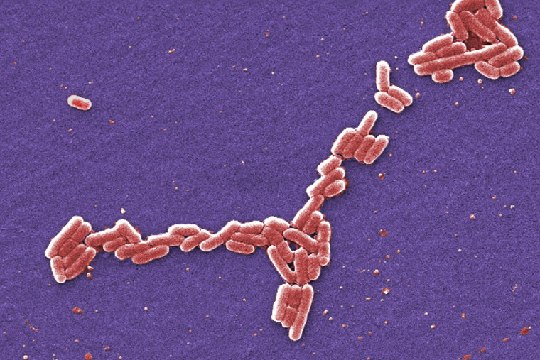 Image: E. coli bacteria of the O157:H7 strain that produces a powerful toxin