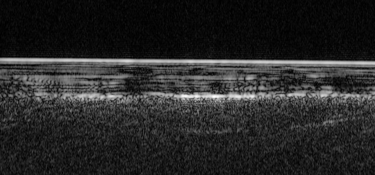 ESA's Mars Express used radar signals bounced through underground layers of ice to identify a pond of water buried below the surface.