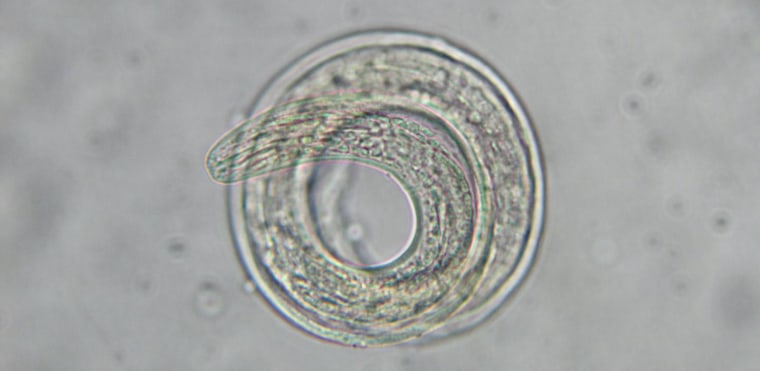 These rat lungworm larvae have reached the infective stage inside their snail host. When a rat eats the snail, it becomes infected with the parasite, which matures and reproduces inside the rat's pulmonary artery.