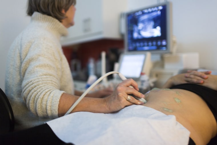 Why you should ask about your hospital's C-section rate, Your Pregnancy  Matters