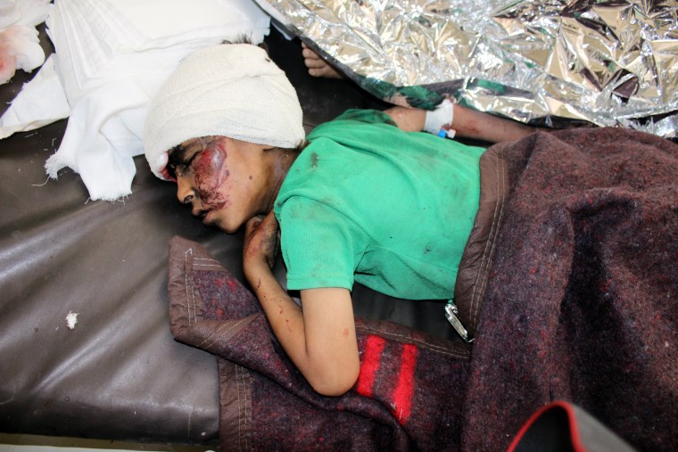 Image: A wounded Yemeni child lies on a bed receiving treatment at a hospital