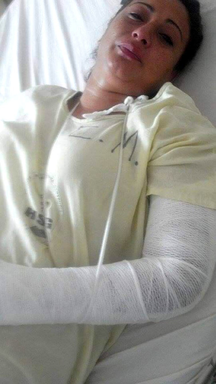 A photo of Raquel in the hospital after she said she was attacked by three police officers in El Salvador. She received over 20 stitches in her arm.