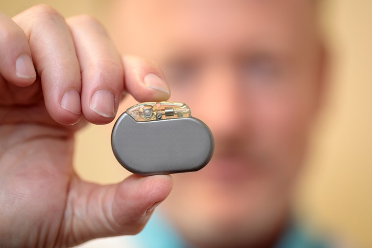 Image: Vagus Nerve Stimulator