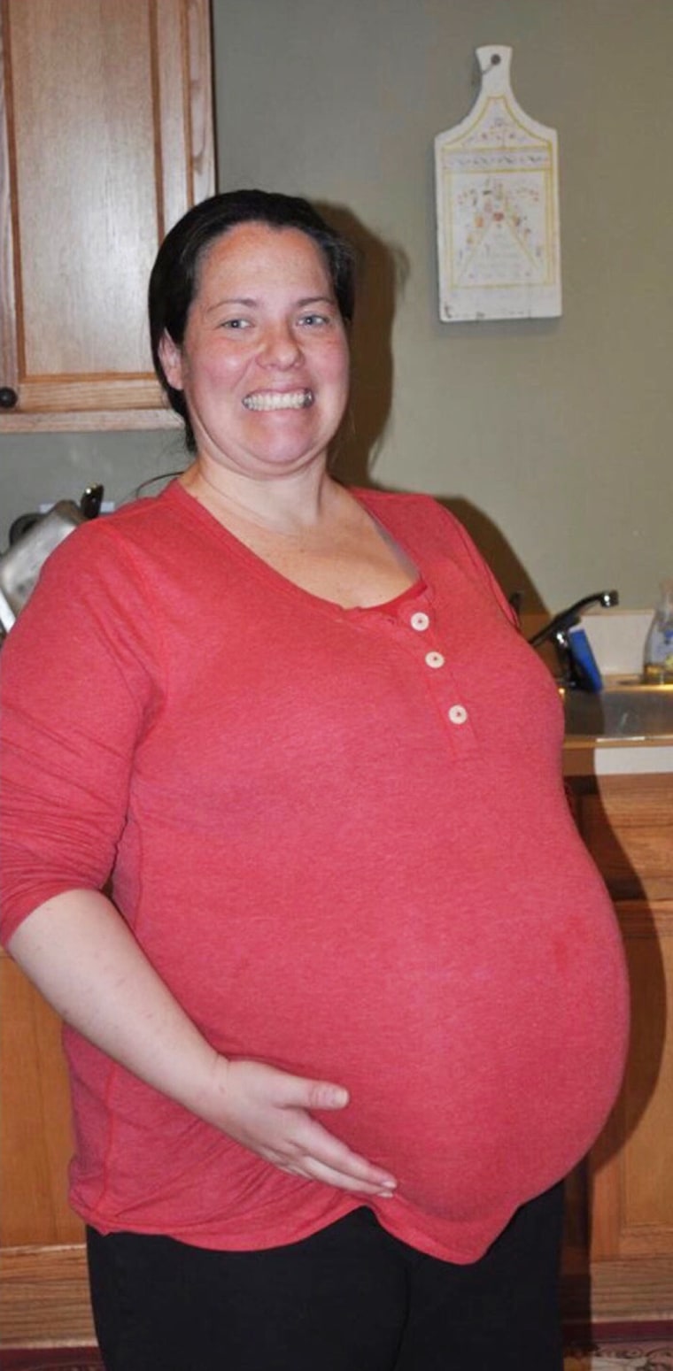 Eileen Daly gained 160 pounds while pregnant and her health suffered greatly.