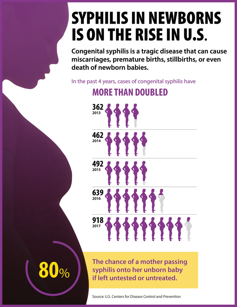 Image: Syphilis in newborns is on the rise in the United States