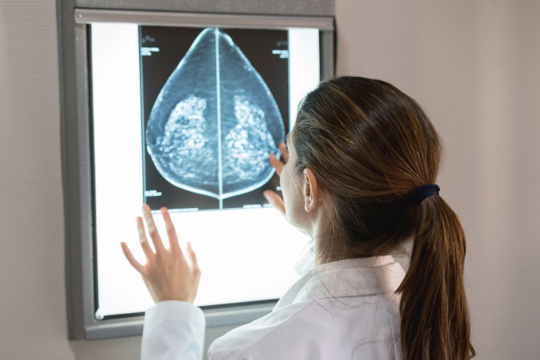 Image: Unrecognizable female gynocologist looking at a mammogram at the hospital