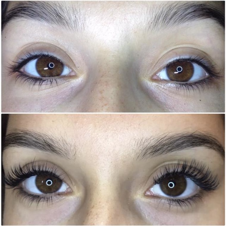 Are eyelash extensions safe?