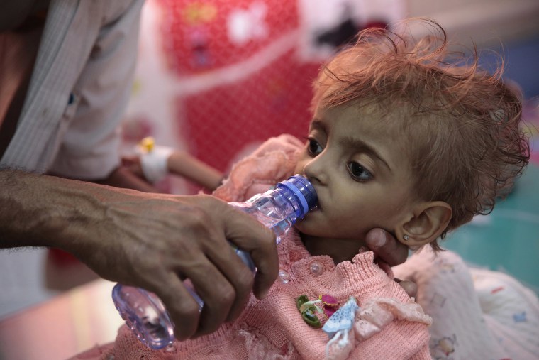 Image: A father gives water to his malnourished daughter at a feeding center in a hospital in Hodeida