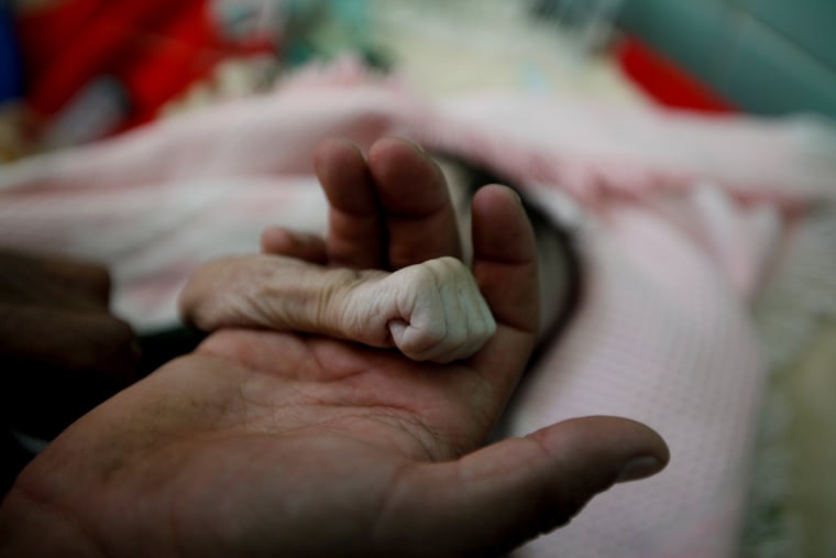 Image: A Picture and its Story: Yemeni father mourns baby girl who died of starvation