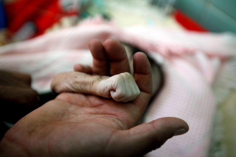 Image: Saleh Hassan al-Faqeh holds the hand of his four-month-old daughter, Hajar, who died at the malnutrition ward of al-Sabeen hospital in Sanaa