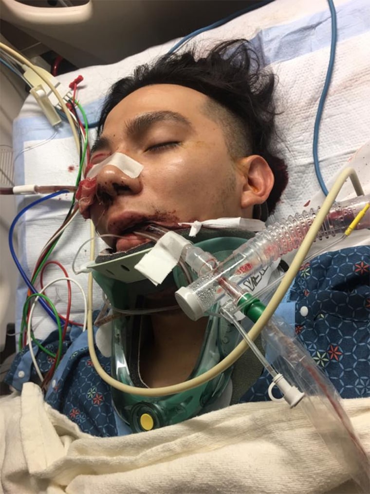Luis Lopez in the hospital following an attack on him and his father, Jose Lopez, in their family tire shop in Salt Lake City, Utah.