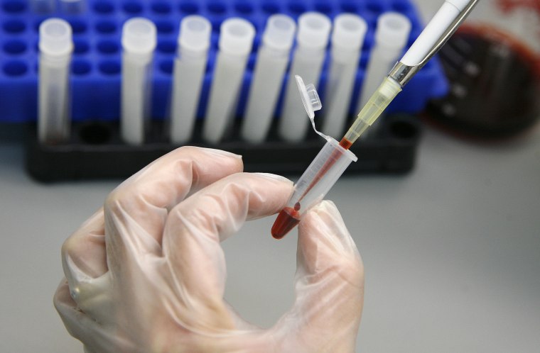 A laboratory technician examines blood samples for HIV/AIDS