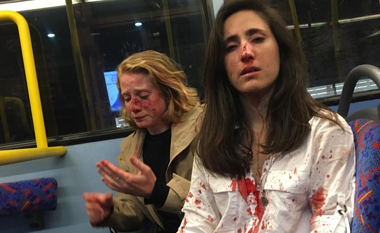 Chris, left, and Melania say they were the victims of a homophobic assault on a London bus.