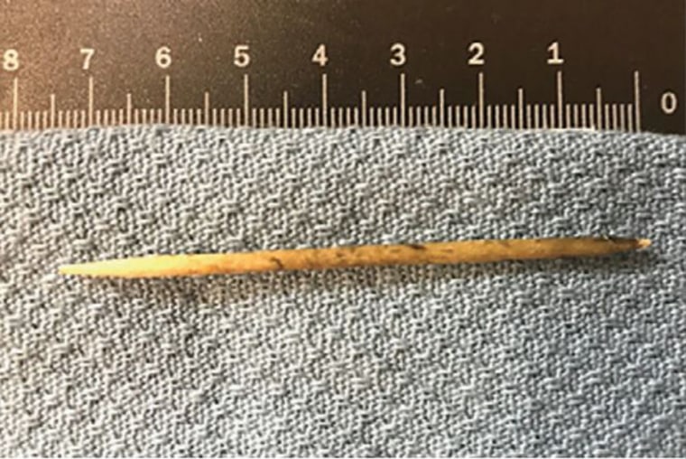 A colonoscopy finally revealed what was wrong: a 2-inch wooden toothpick lodged in the man’s colon. 