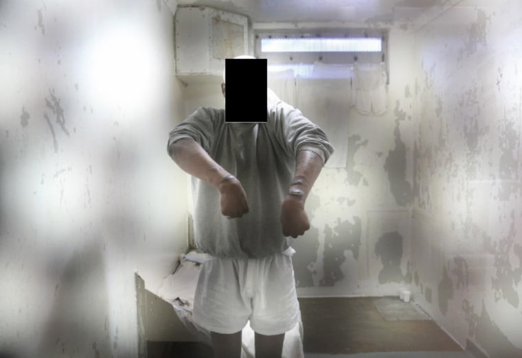 Image: An inmate shows self-inflicted lacerations inside his solitary confinement cell in E-Wing. Face redacted by source.