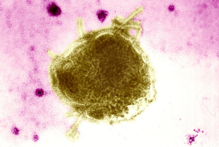 Paramyxoviridae Virus