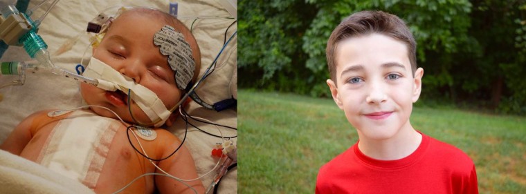 It's been 10 years since Elijah was born with hypoplastic left heart syndrome. He participated in 10 year challenge with Children's Healthcare of Atlanta to show how far he has come.