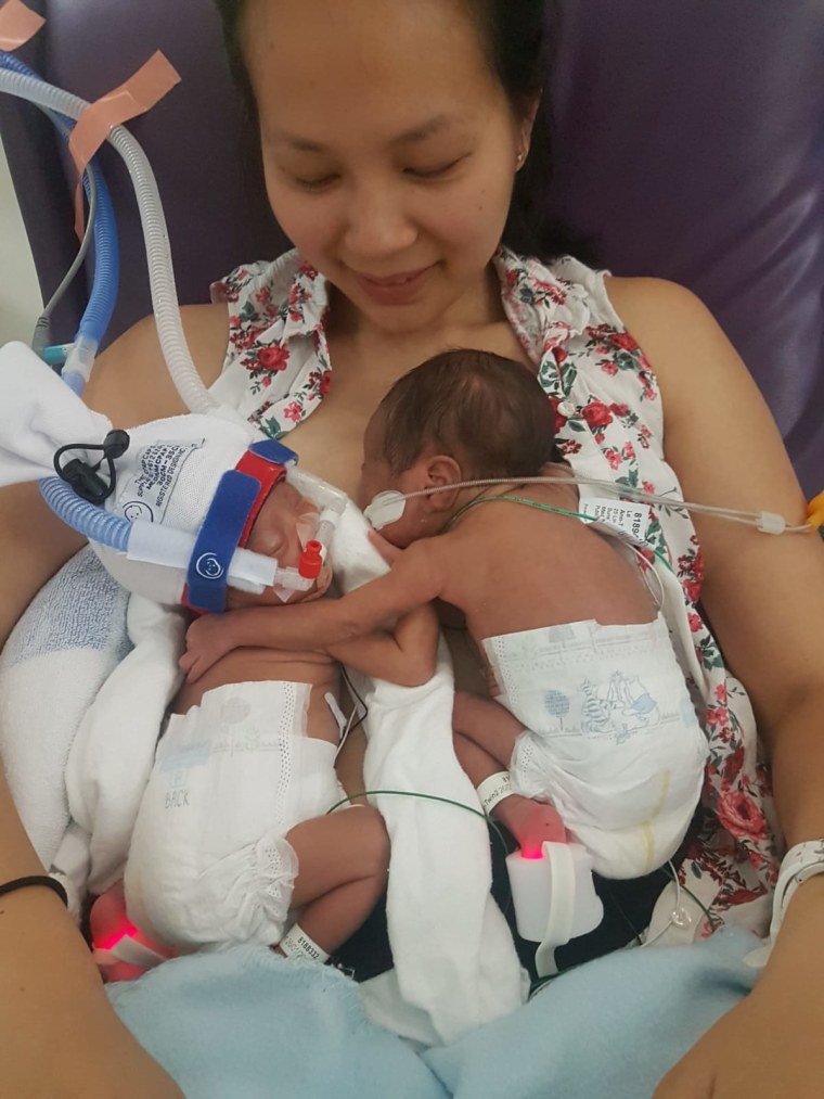 Ann Le gave birth to mono-chorionic mono-amniotic twin daughters in January 2019. The pair was recently reunited in the hospital NICU for the first time since their delivery.