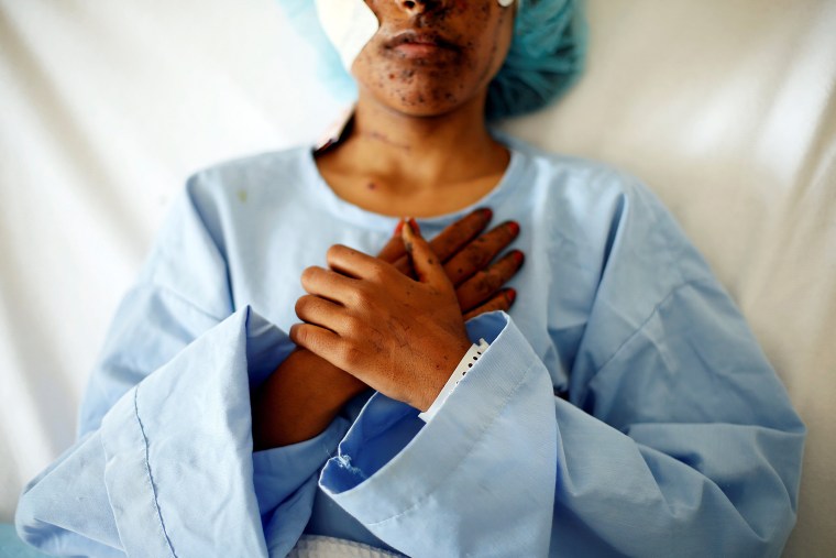 Image: A woman who was injured in air strikes lies in a hospital bed in Sanaa