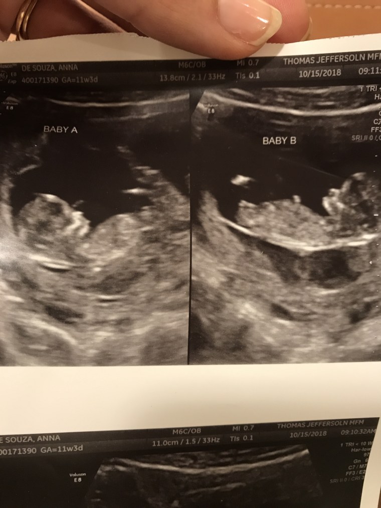 What were my twins' very first names? Baby A and Baby B. Now that was easy!