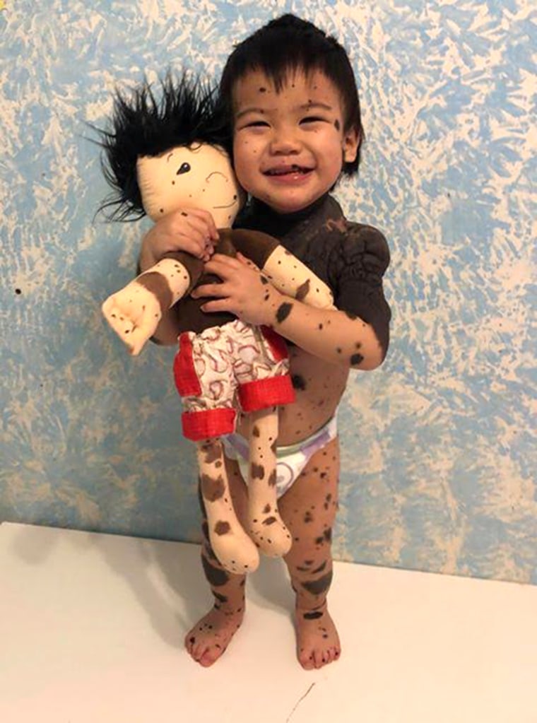 Kids with differences see themselves in A Doll Like Me