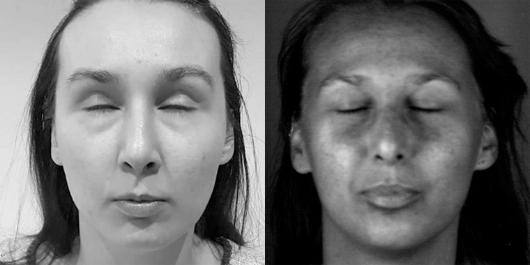 face with sunscreen and without