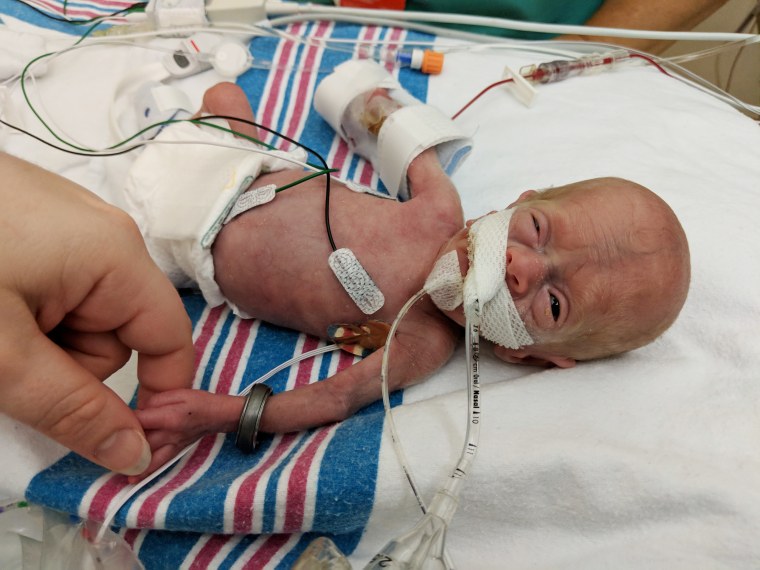 Premature baby weighing just over 1 pound at birth goes home from hospital