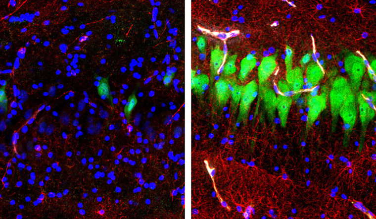 Immunofluorescent stains for neurons (green), astrocytes (red), and cell nuclei (blue) in a region of the hippocampus of a pig's brain left untreated 10 hours after death (left) or subjected to perfusion with the BrainEx technology. Ten hours postmortem, neurons and astrocytes undergo cellular disintegration unless salvaged by the BrainEx system.