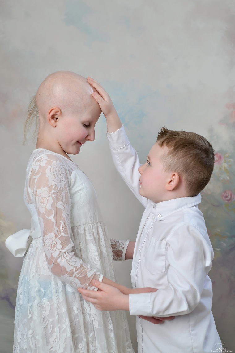 Connor Lloyd took a sweet photo with Rheann Franklin, who can no longer grow hair because of intense radiation treatments to her skull.