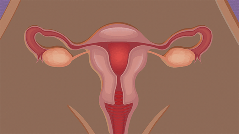 uterine fibroids symptoms and treatment