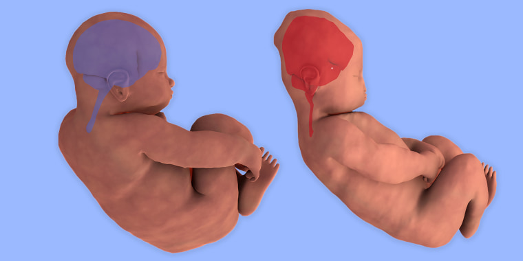 What happens to a baby's head during childbirth?