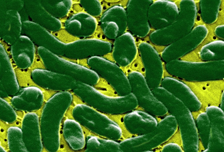 Vibrio vulnificus