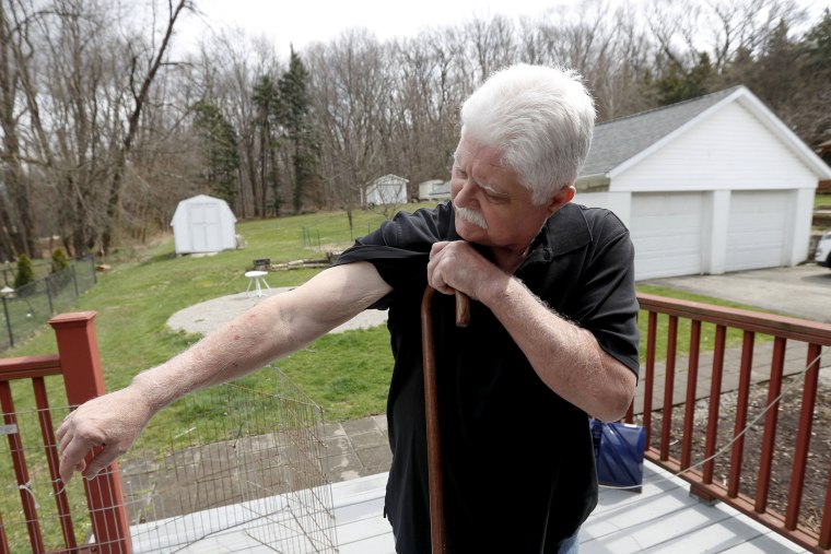 Image: Chuck Pope, who suffers from rheumatoid arthritis, shows the condition of his arms at his home in Derry, Pennsylvania, on April 8, 2019.