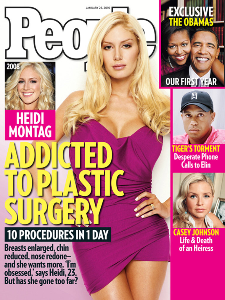 Montag revealed her extensive plastic surgeries in People magazine in 2010.