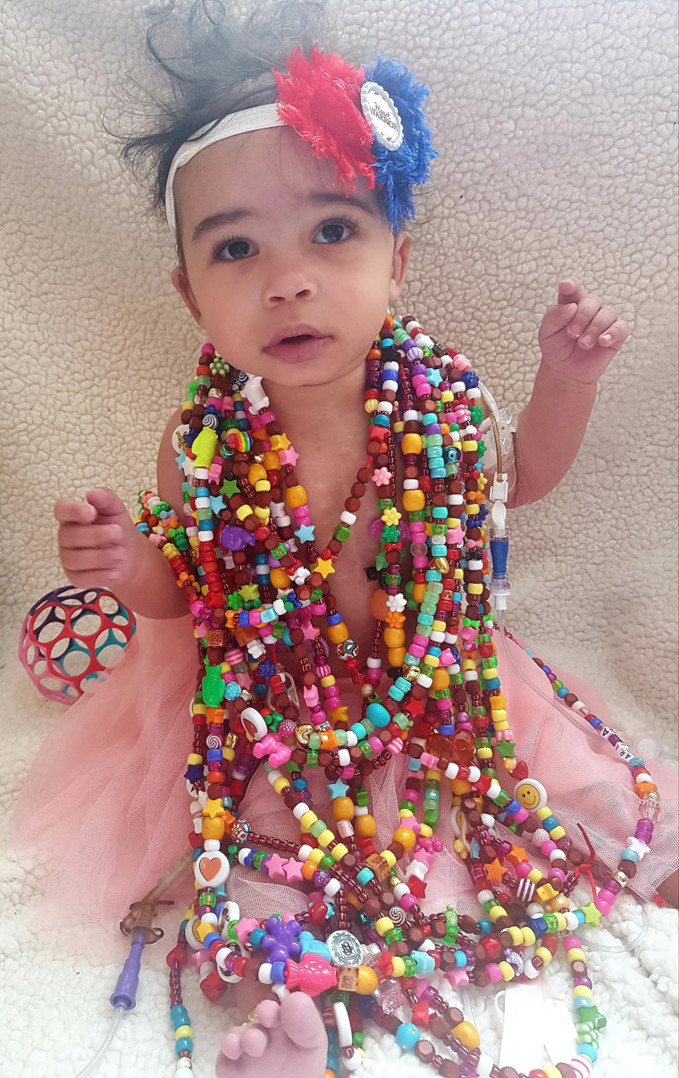 Amira, who is 18 months old, has had three open-heart surgeries.