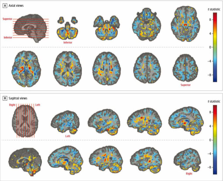 Image: Brain scan