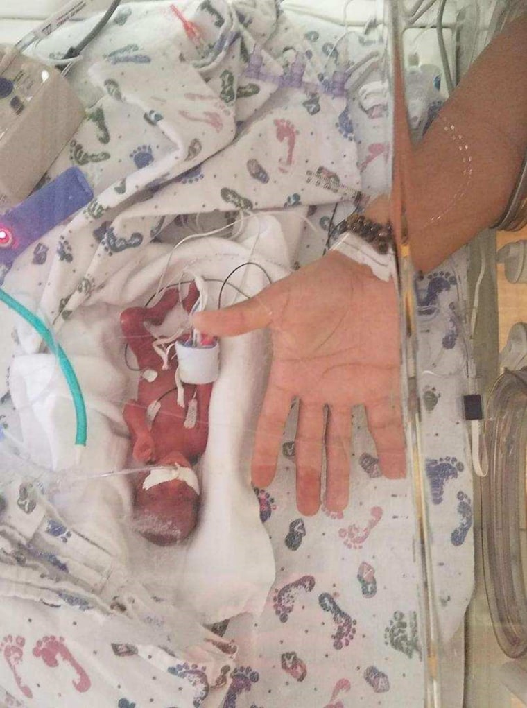 Baby Jaden weighed 13 ounces when he was born at 23 weeks gestation.