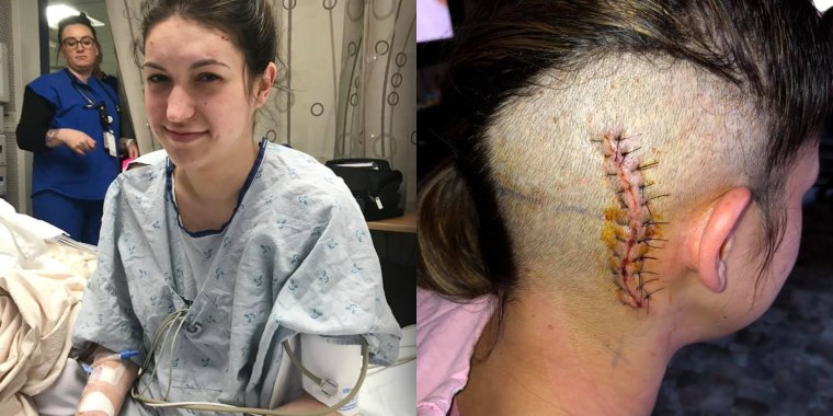Christina Anderson, 24, had surgery to remove a huge brain tumor just three months before her wedding.