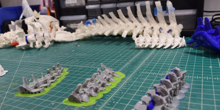 Dr. Mark Magazu, a veterinarian, studied a 3D printed spine model before operating on Andy the dachshund.