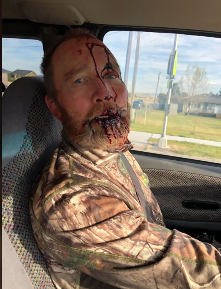 Image: Two hunters who were attacked by grizzly bears in Montana are treated in hospital.
