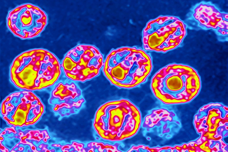 Image: Colorized electron microscope image of the HIV virus