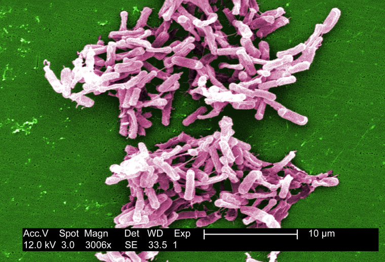 This micrograph depicts Gram-positive C. difficile bacteria from a stool sample.

