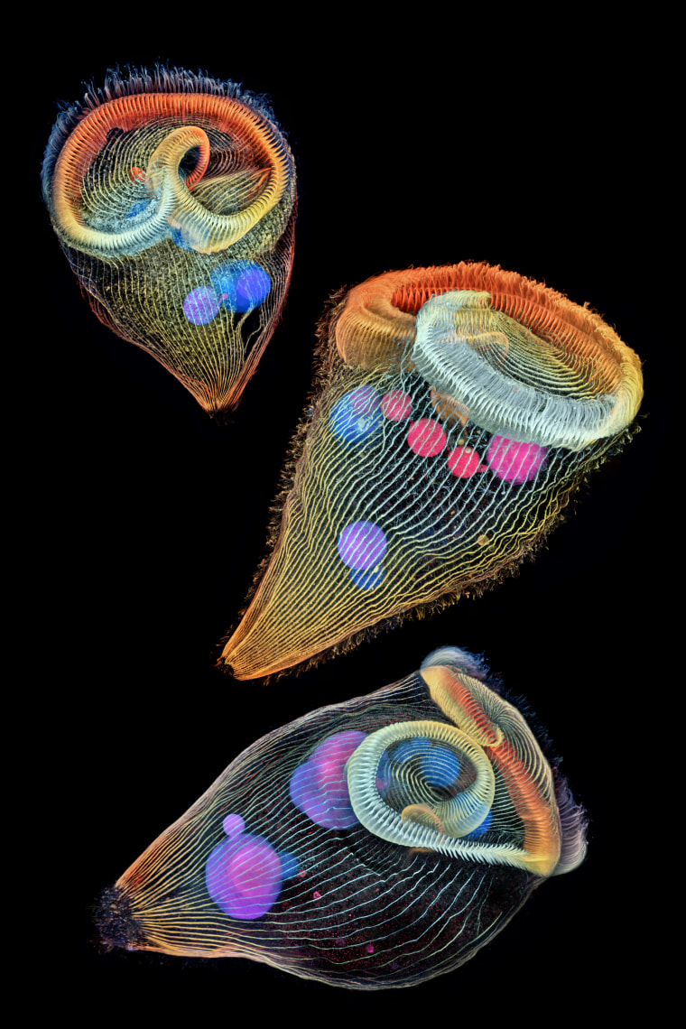 Image: Depth-color coded projections of three stentors (single-cell freshwater protozoans), Second Place