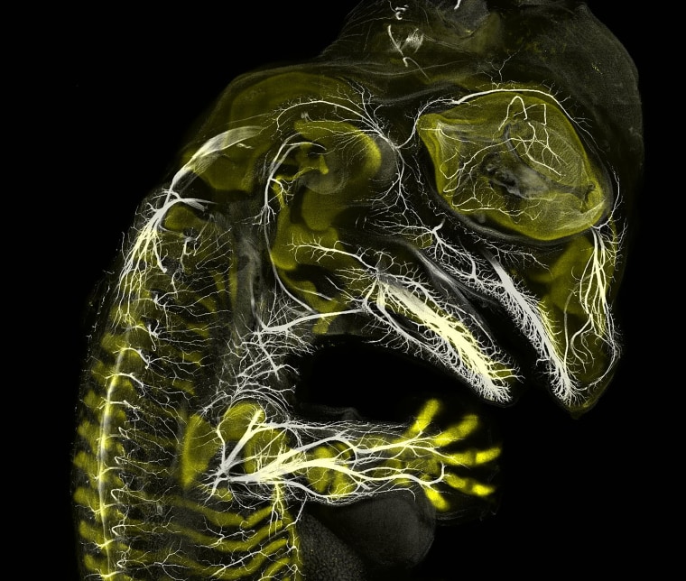 Image: Alligator embryo developing nerves and skeleton, Third Place