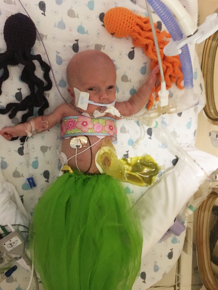 2-month-old Lily in her mermaid costume last Halloween. 