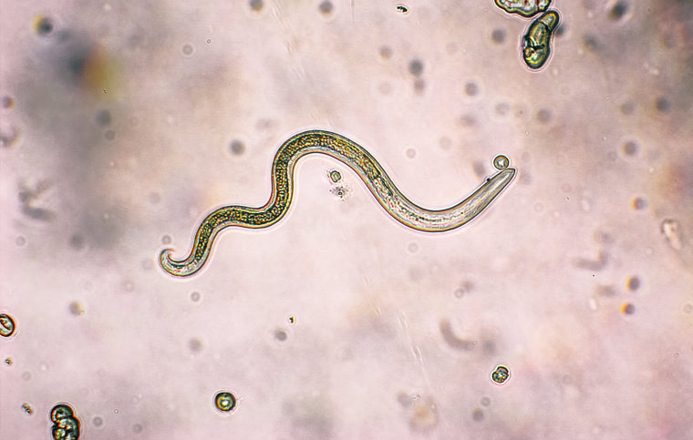 Image: A roundworm that causes Toxocariasis under a microscope.