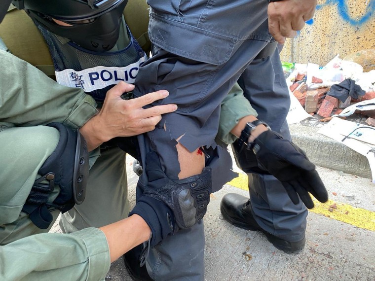 Image: Hong Kong police officer with arrow in leg