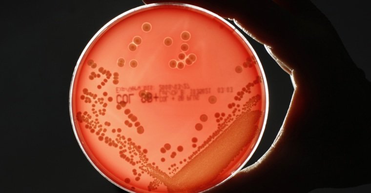 Image: MRSA bacteria are seen in a petri dish in a microbiological laboratory in Berlin
