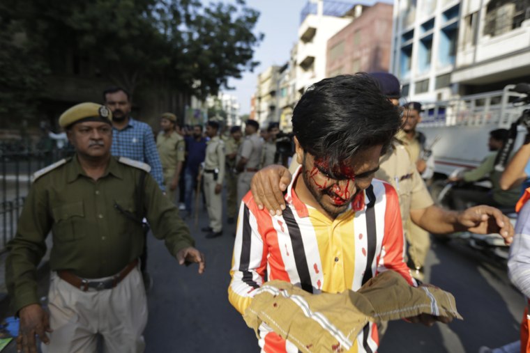 Image:Police officers escort a man injured in a baton charge at a protest against a new citizenship law in Ahmadabad
